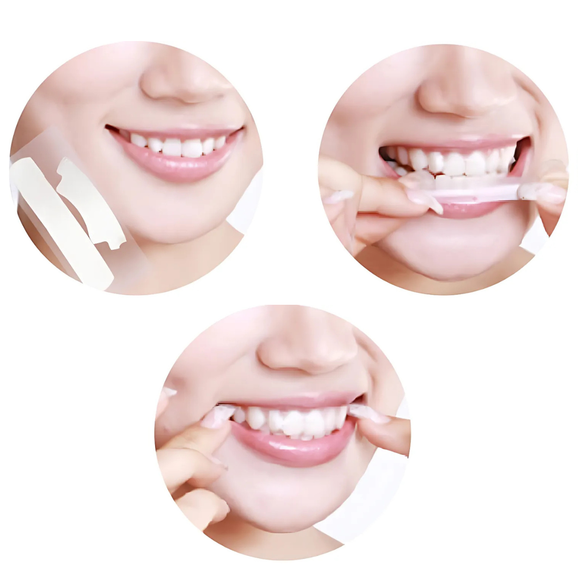Smilumin – Fogfehérítő készlet csíkokkal és LED lámpával